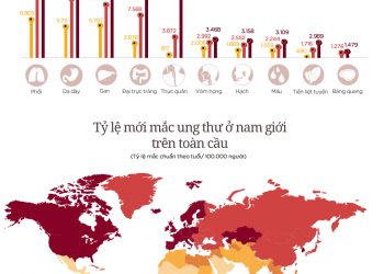 10 bệnh ung thư phổ biến ở nam giới Việt Nam