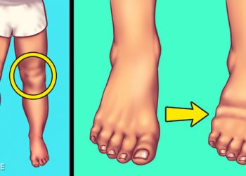 7 dấu hiệu bạn đang ăn quá nhiều muối