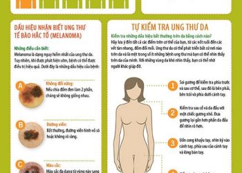 Dấu hiệu cảnh báo ung thư da