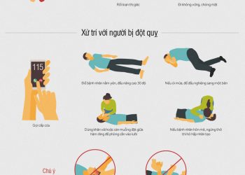 Dấu hiệu nhận biết sớm và xử trí khi người thân bị đột quỵ