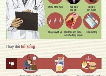 Dự phòng đột quỵ