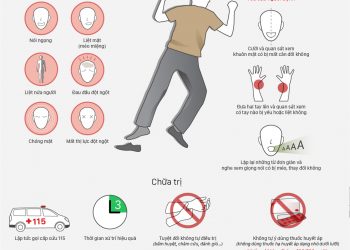 Làm thế nào nhận biết một người đang bị đột quỵ