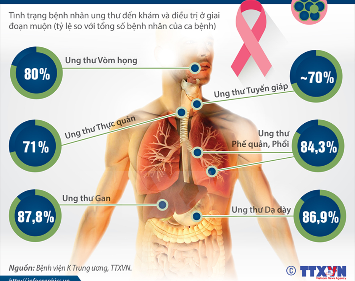 Người Việt ung thư dễ chết do thường phát hiện muộn